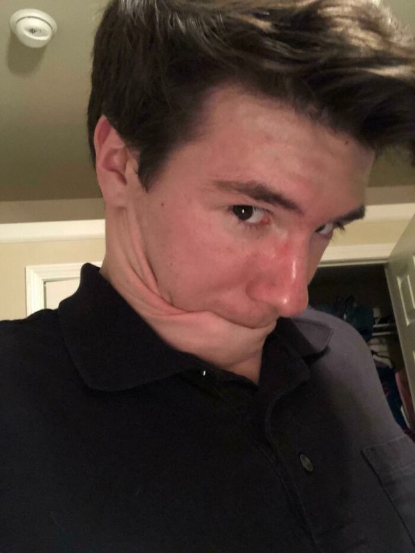 People With Unusual Features (22 pics)