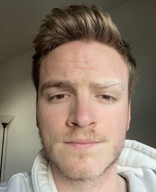 People With Unusual Features (22 pics)