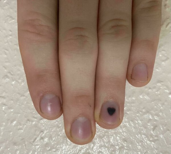 People With Unusual Features (22 pics)