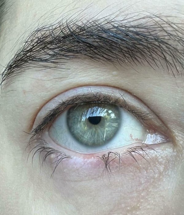 People With Unusual Features (22 pics)