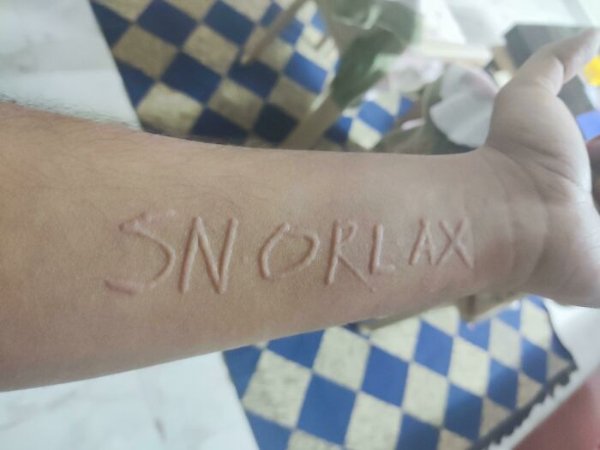 People With Unusual Features (22 pics)