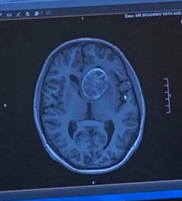 People With Unusual Features (22 pics)