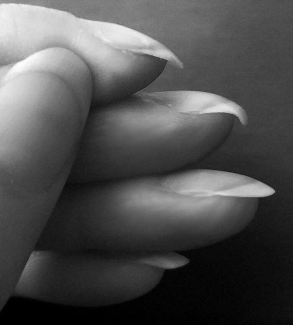 People With Unusual Features (22 pics)