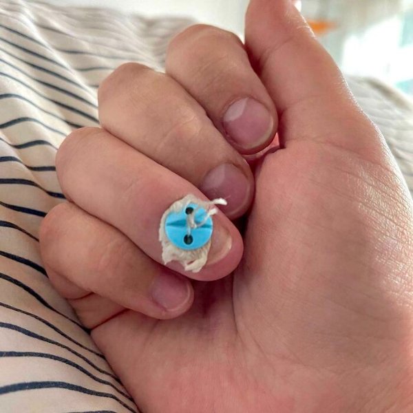 People With Unusual Features (22 pics)