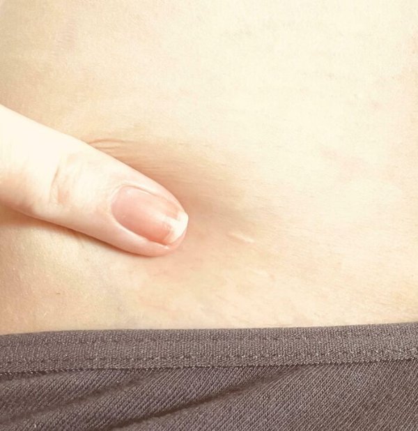 People With Unusual Features (22 pics)