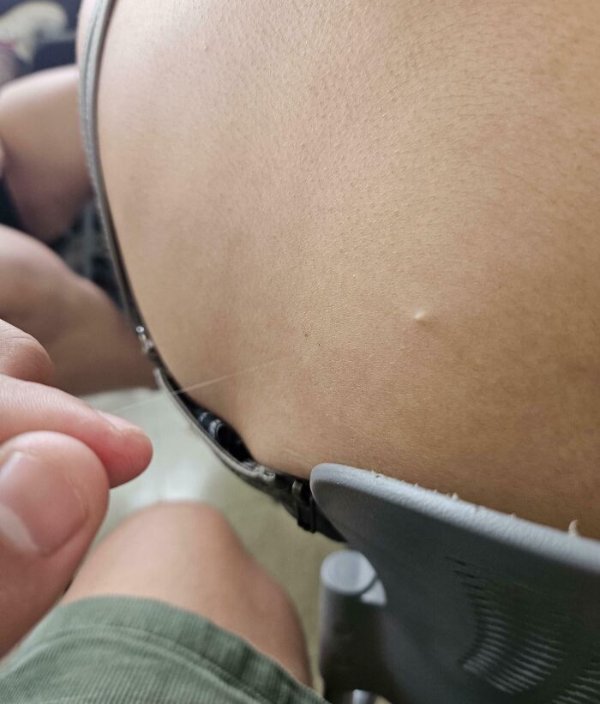 People With Unusual Features (22 pics)