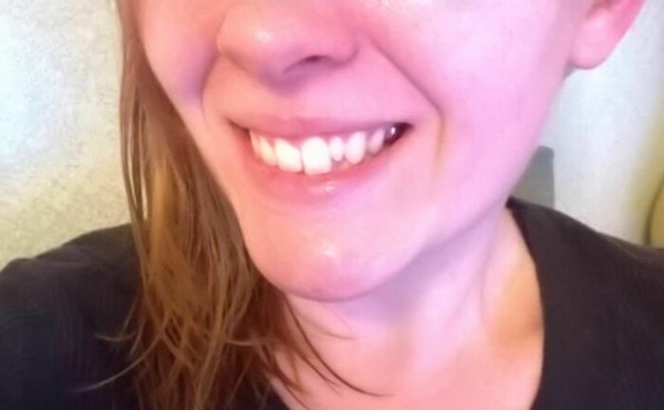 People With Unusual Features (22 pics)