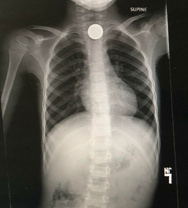 Expensive Fails (31 pics)