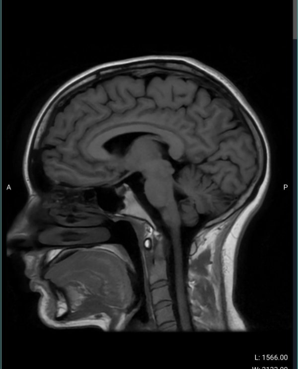 Unusual Finds And Discoveries (33 pics)