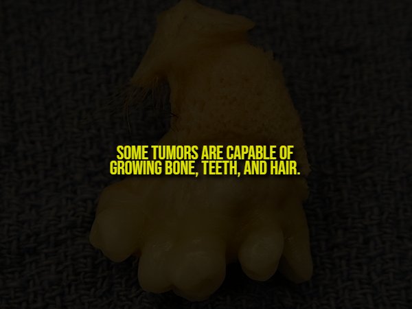 Creepy Facts (14 pics) Creepy Facts (14 pics)