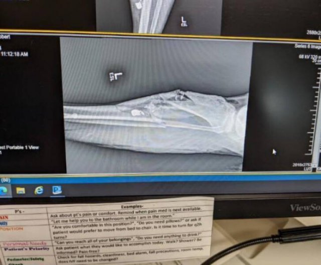 Bad Days Happen (25 pics)