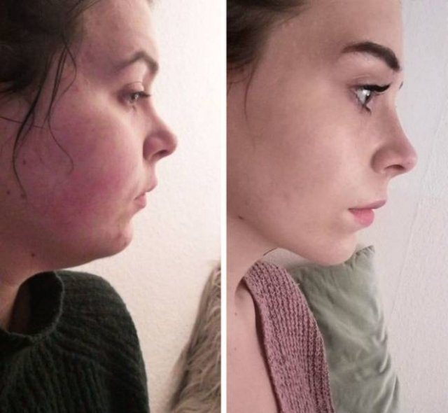 Radical Changes (19 pics)