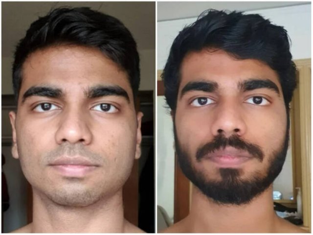 Men With And Without Beards (18 pics)