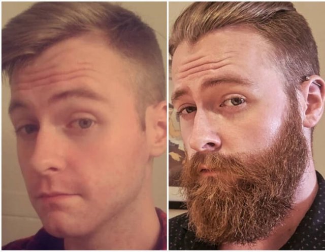 Men With And Without Beards (18 pics)