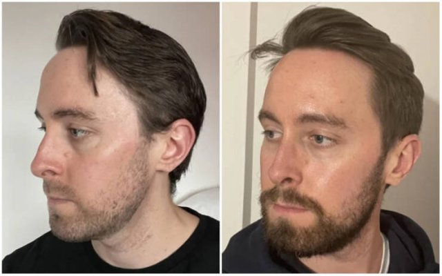 Men With And Without Beards (18 pics)