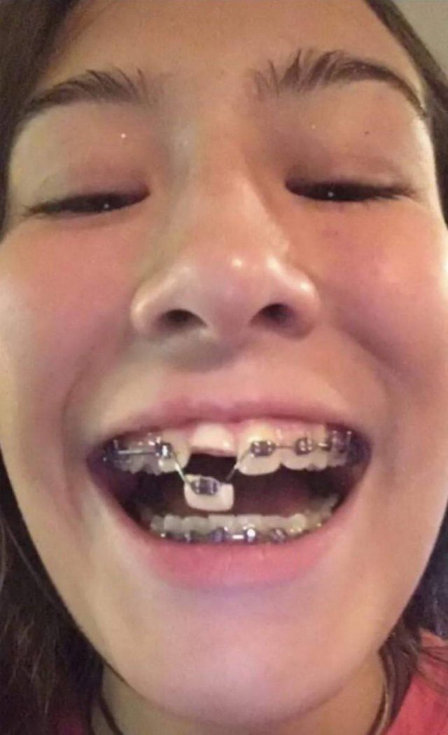 Bad Days Happen (48 pics)