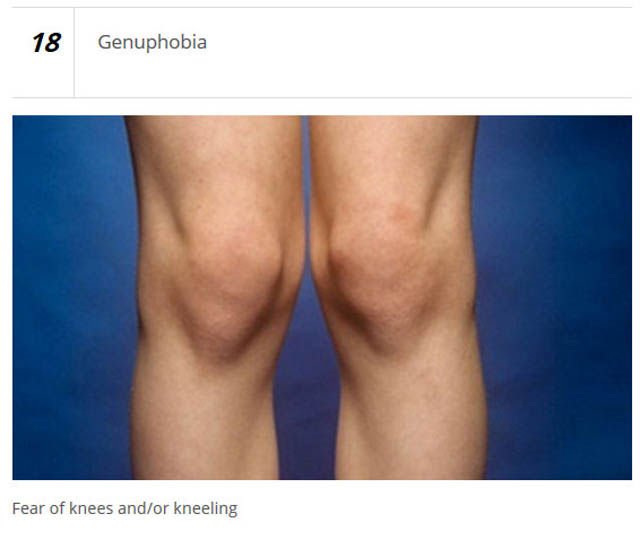 Unusual Phobias (25 pics)