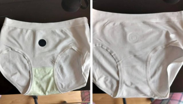 What Are These Things? (19 pics)