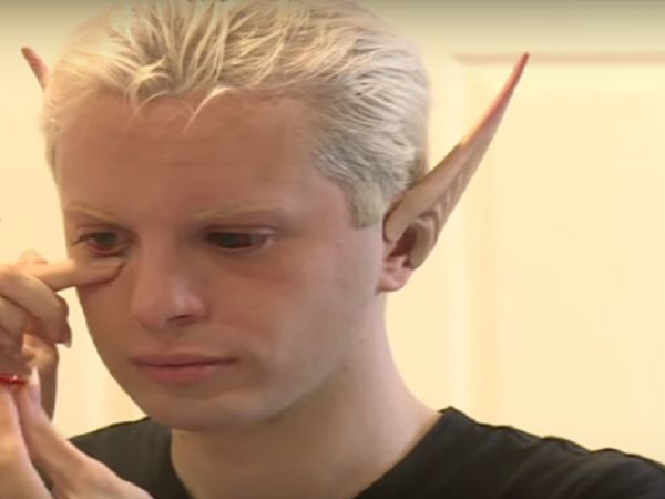 Man Spends $30,000 On Plastic Surgery To Become An Elf?!?