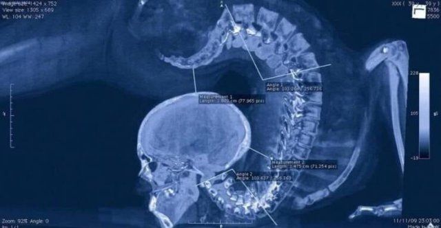 Unusual X-Rays (22 pics)