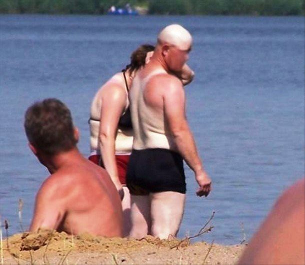 Weird And Funny Sunburns (18 pics)