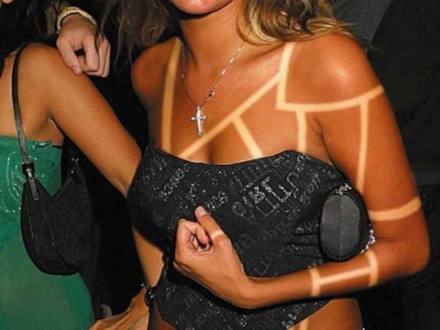 Weird And Funny Sunburns (18 pics)
