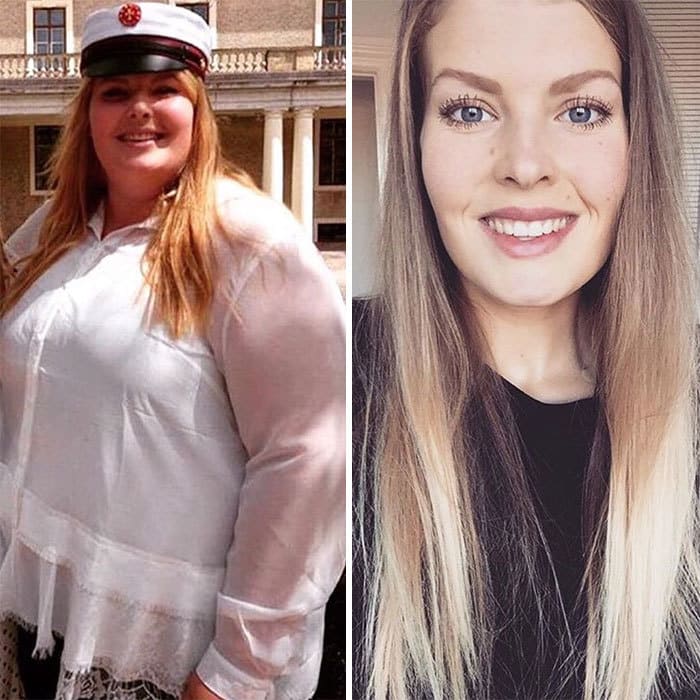 People Before And After Losing Weight (20 pics)