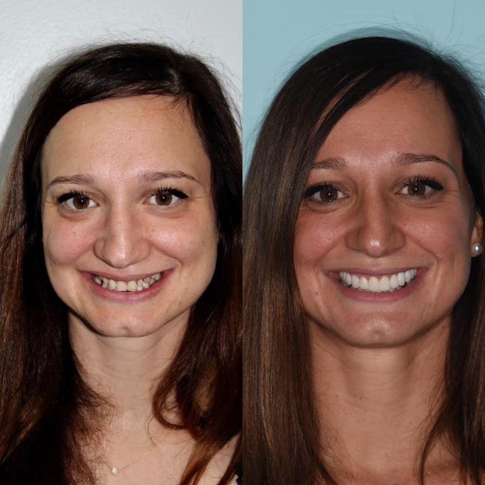 Interesting Before And After Photos (18 pics)
