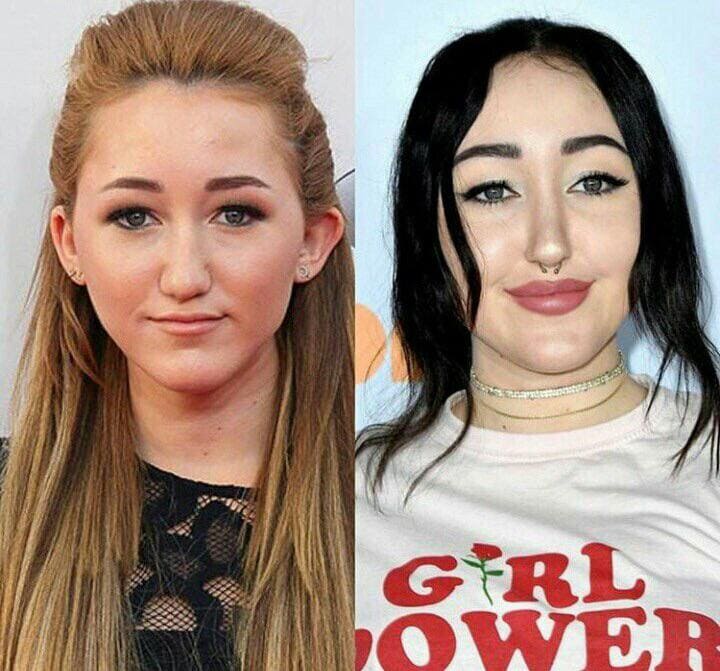 People Before And After Plastic Surgery (17 pics)