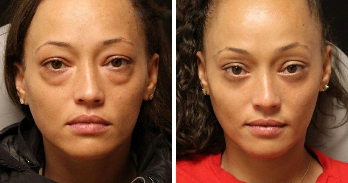 People Before And After Plastic Surgery (17 pics)