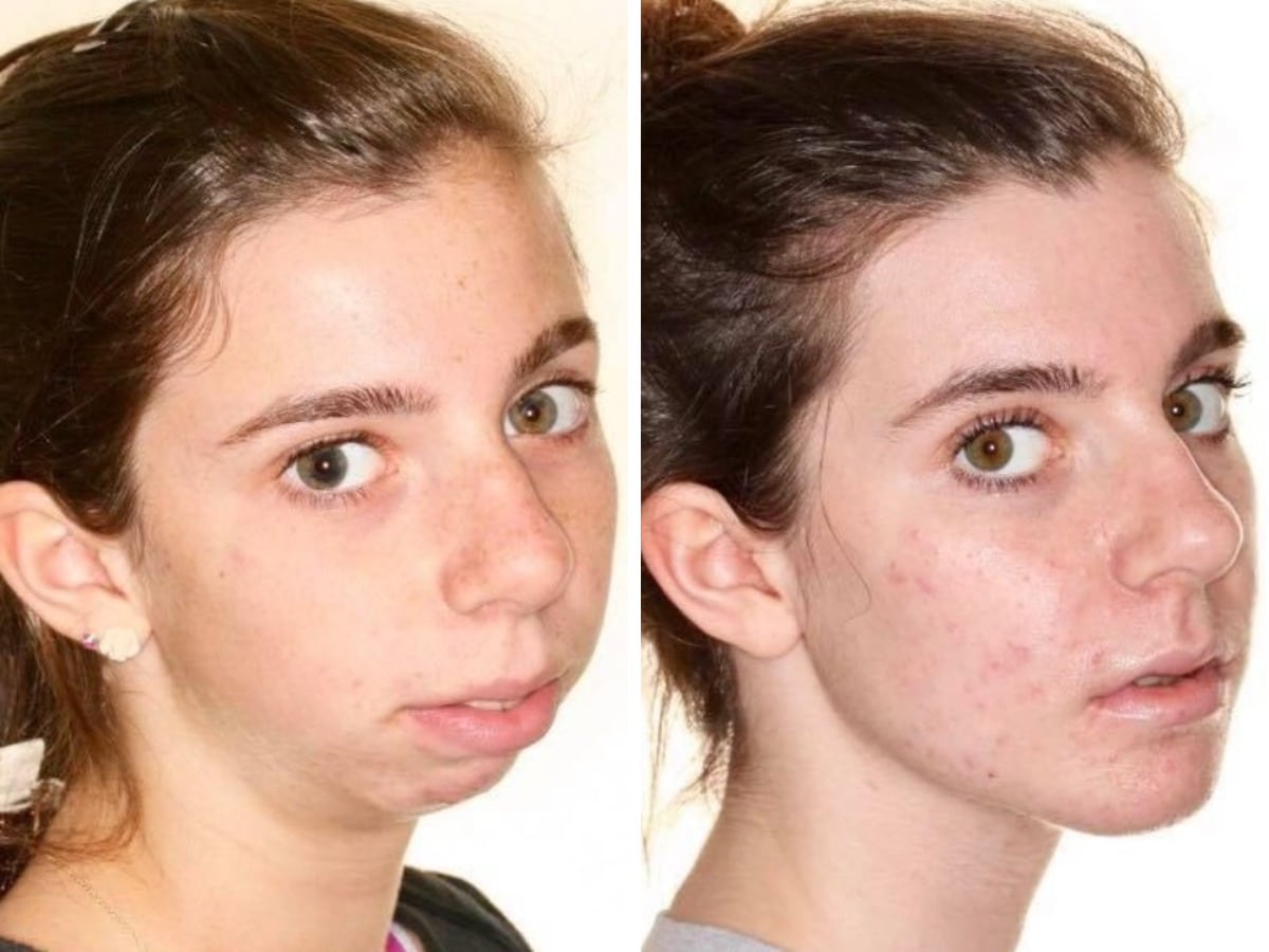 People Before And After Plastic Surgery (17 pics)