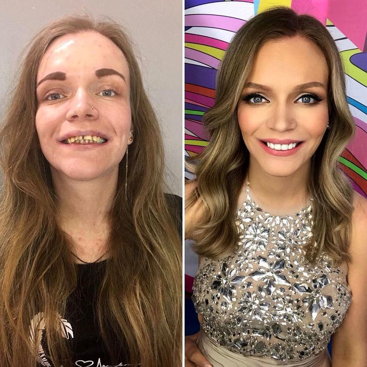 Girls With And Without Makeup (18 pics)