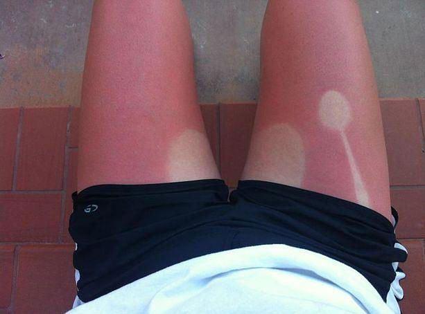 Failed Tan (22 pics)