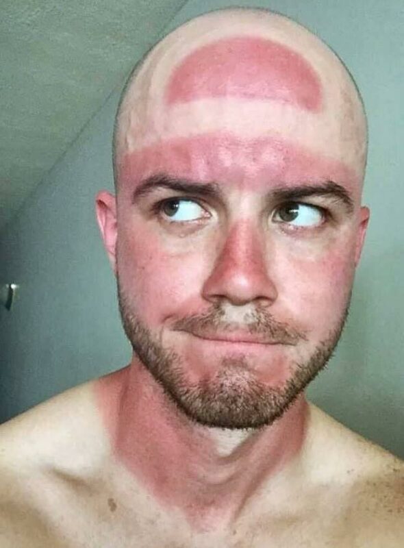 Failed Tan (22 pics)