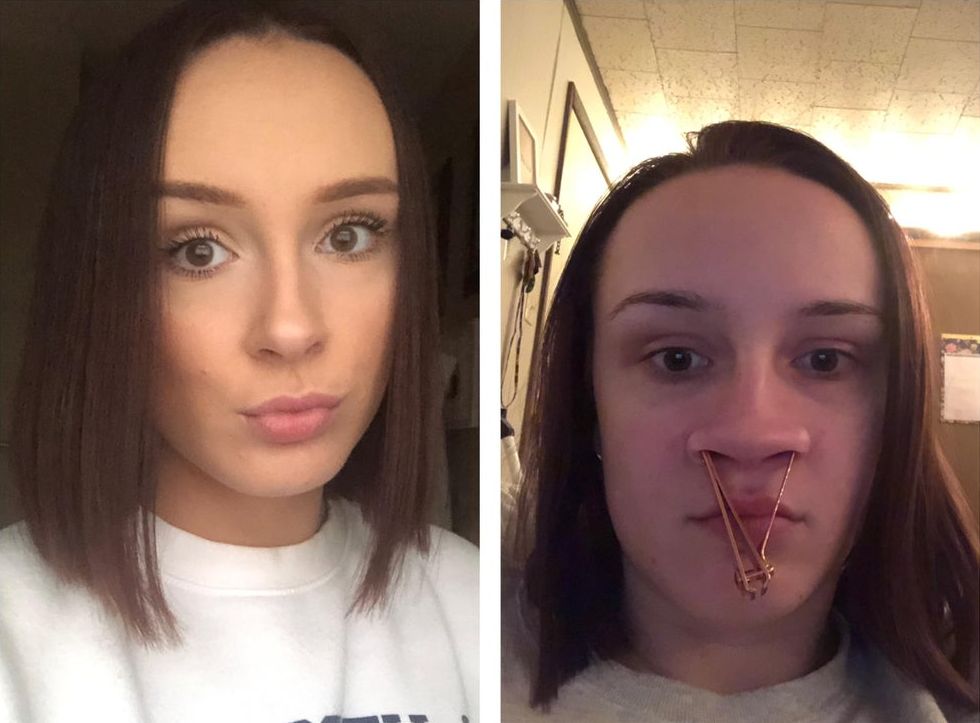 Funny Girls Share Their Awkward Photos (18 pics)