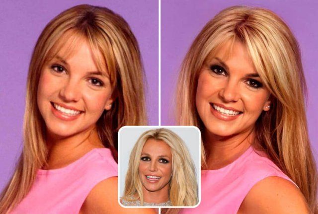 Famous People And Plastic Surgeries (21 pics)
