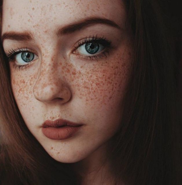 Girls With Freckles (20 pics)