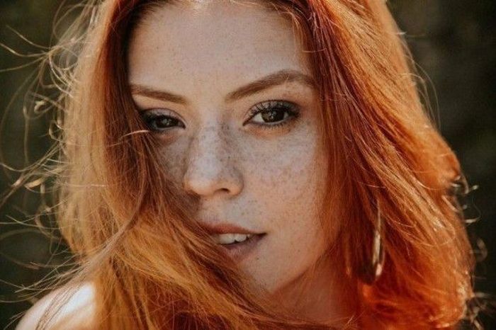 Girls With Freckles (20 pics)