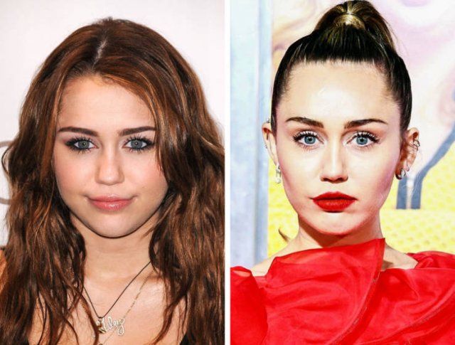 Celebrities Before And After Plastic Surgery (12 pics)
