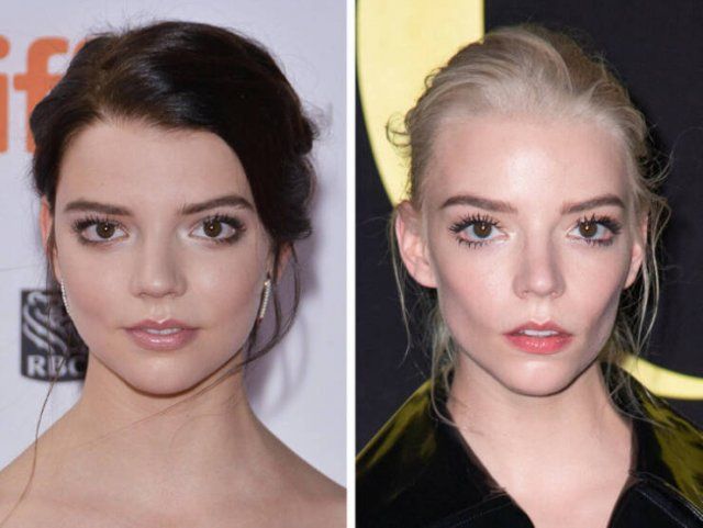 Famous Women Before And After Plastic Surgery (14 pics)