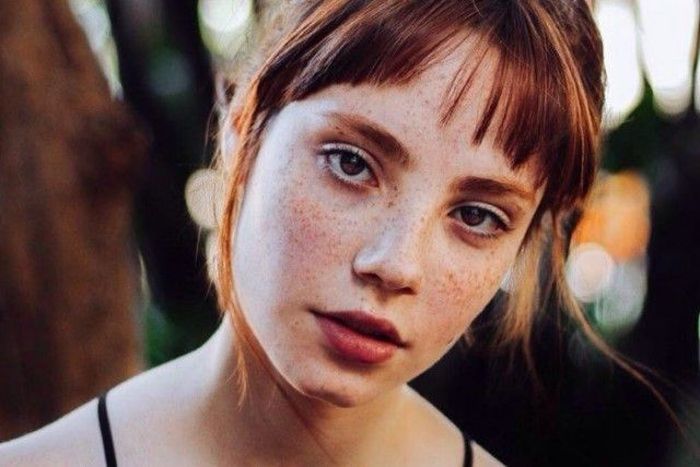 Girls With Freckles (20 pics)
