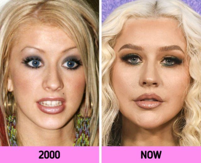 How Faces Of Celebrities Changed Over The Years (11 pics)