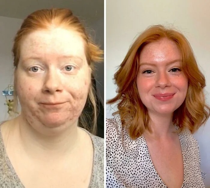 People Who Changed Themselves (20 pics)
