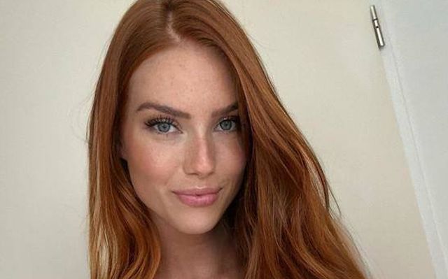 Girls With Freckles (28 pics)