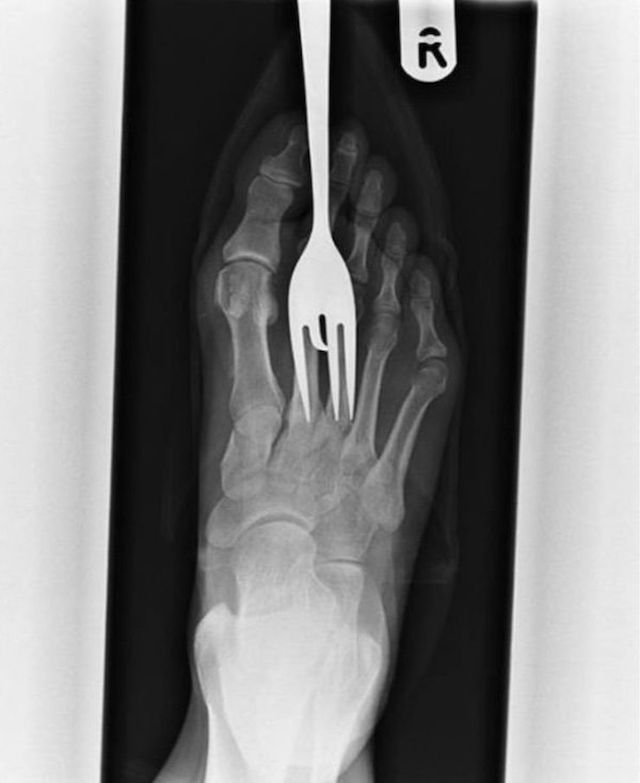 Crazy X-Rays (28 pics)