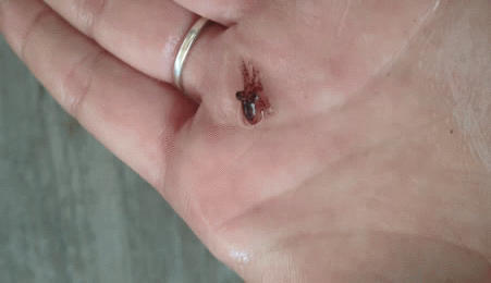 Acid GIFs, January 2 (25 gifs)