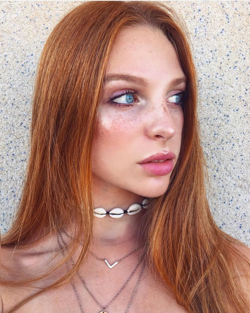 Girls With Freckles (20 pics)