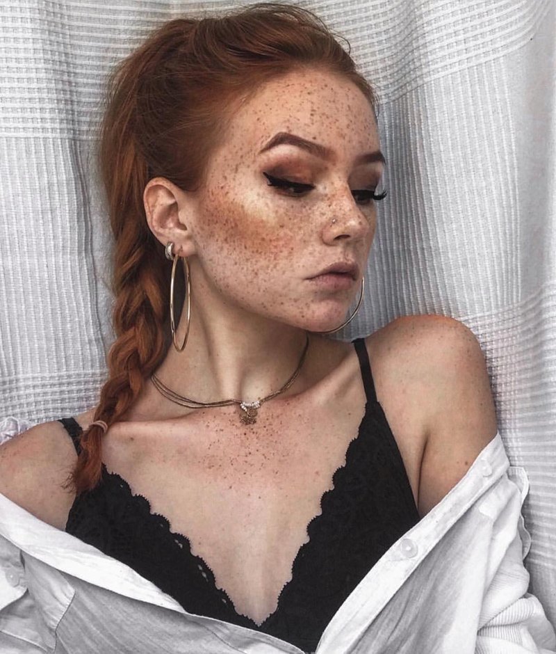 Girls With Freckles (20 pics)