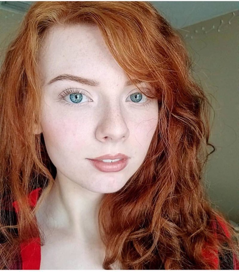 Girls With Freckles (20 pics)