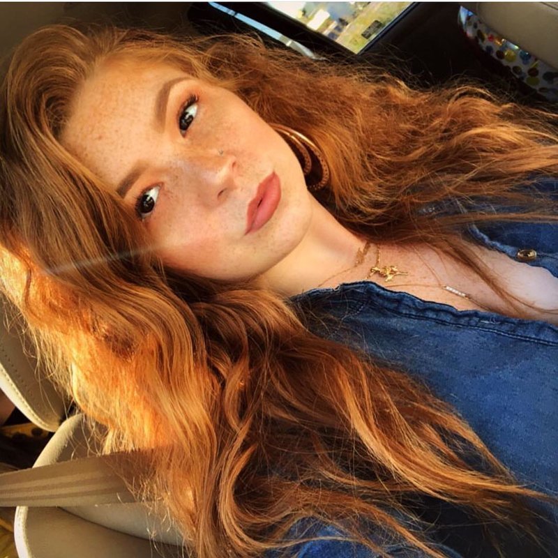 Girls With Freckles (20 pics)